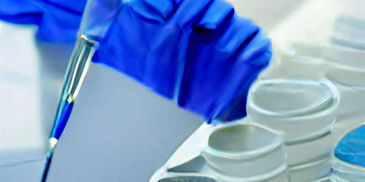 Legionella Testing Market– Current Trends and Future Opportunities Analysis Report 2022-2027