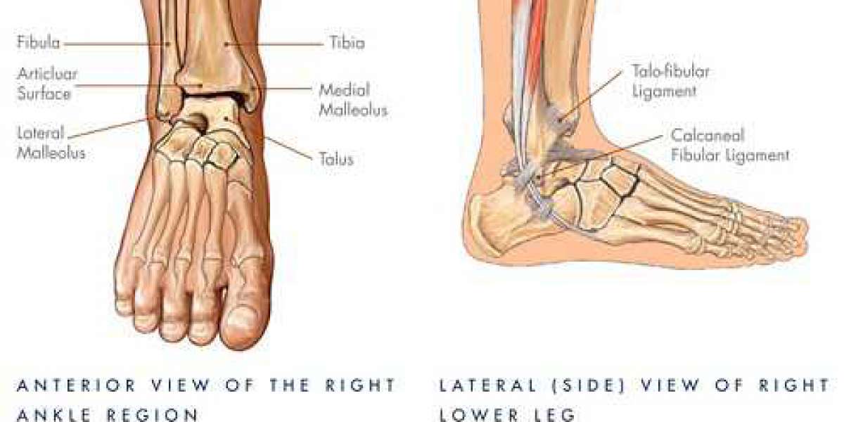 Do You Need Ankle Replacement? Know More About The Surgery