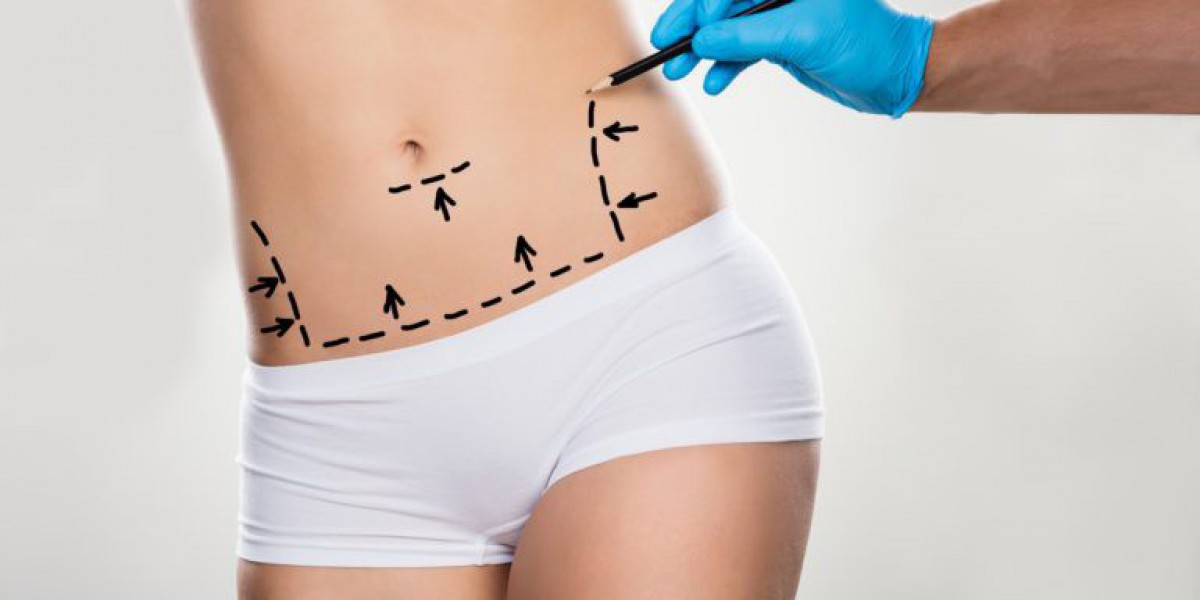 Tummy Tuck for Aging Gracefully: Reducing Belly Sagging