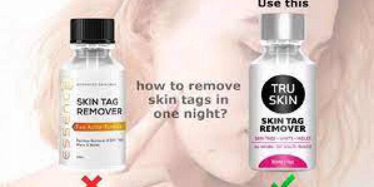 The One Thing All Tru Skin Tag Remover Review Success Stories Have in Common