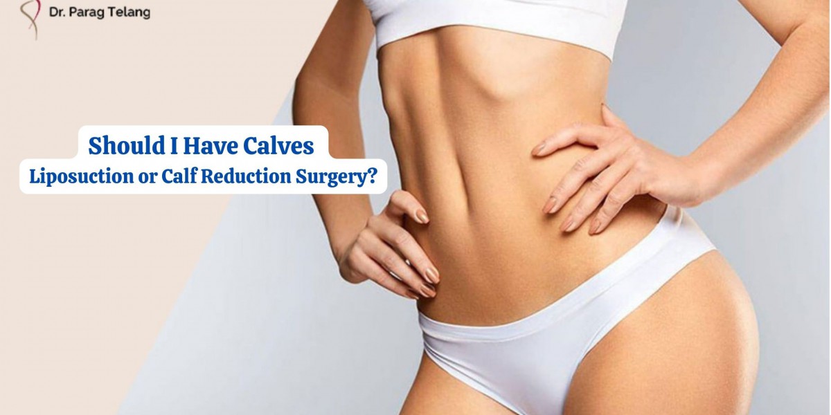 Should I Have Calves Liposuction or Calf Reduction Surgery?