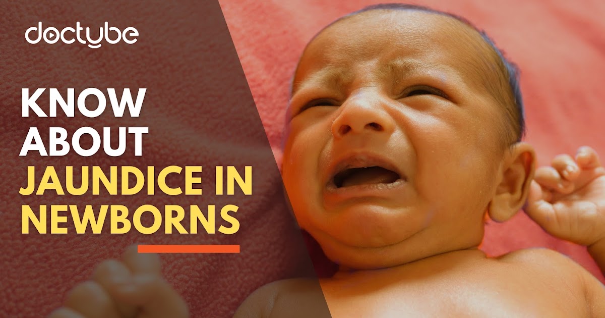 Know About Jaundice in Newborns - DocTube™ : Healthcare