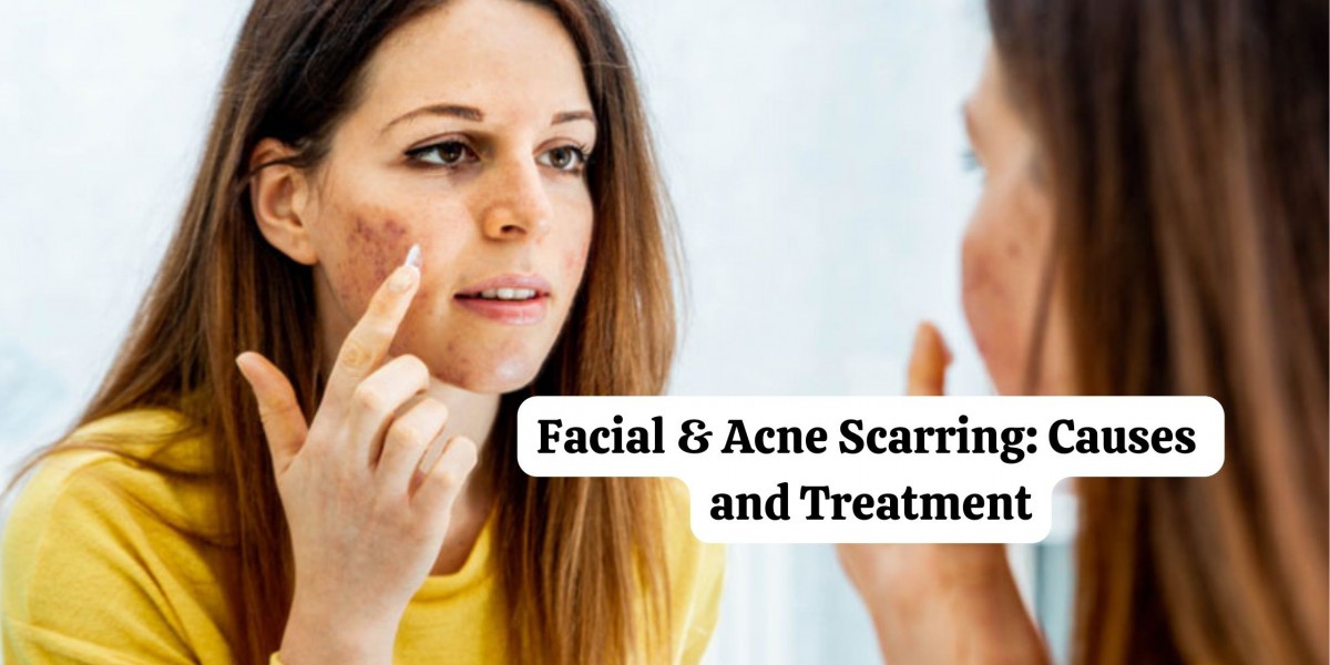 Facial & Acne Scarring: Causes and Treatment