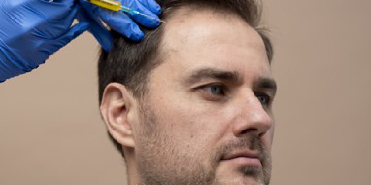 Understanding Hair Transplant Costs at Lahore Cosmeticoplasty