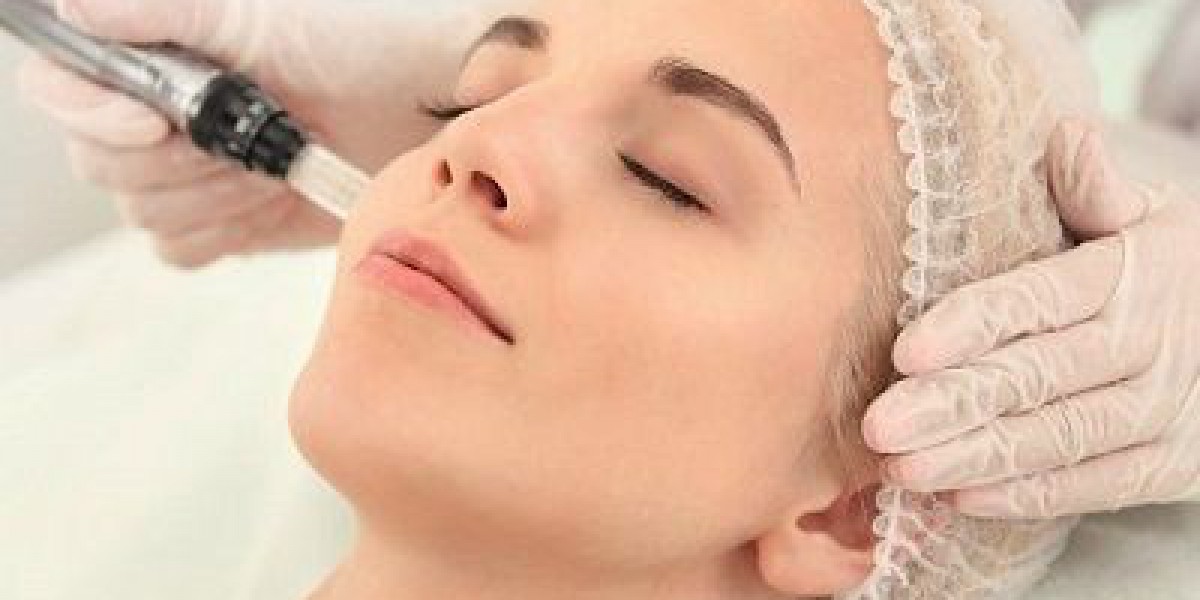 Unveil Your Beauty: Microneedling Treatment in Dubai