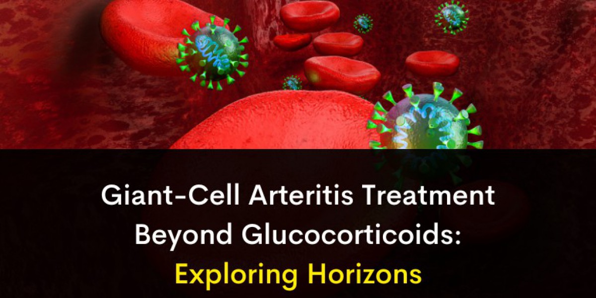 Beyond Glucocorticoids: Advancements in Giant-Cell Arteritis Treatment Strategies