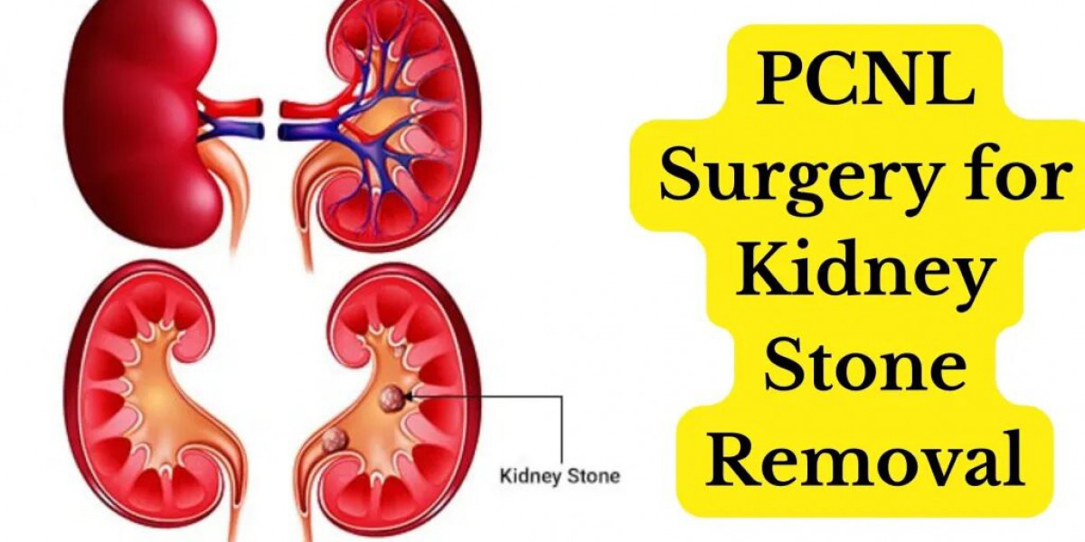 The Link Between Dehydration and Kidney Stones Explained