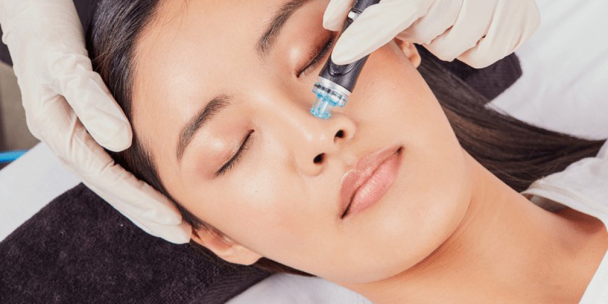 Skin Nirvana: 5 Reasons Why Hydrafacial Treatment Is Your Pathway to Radiance