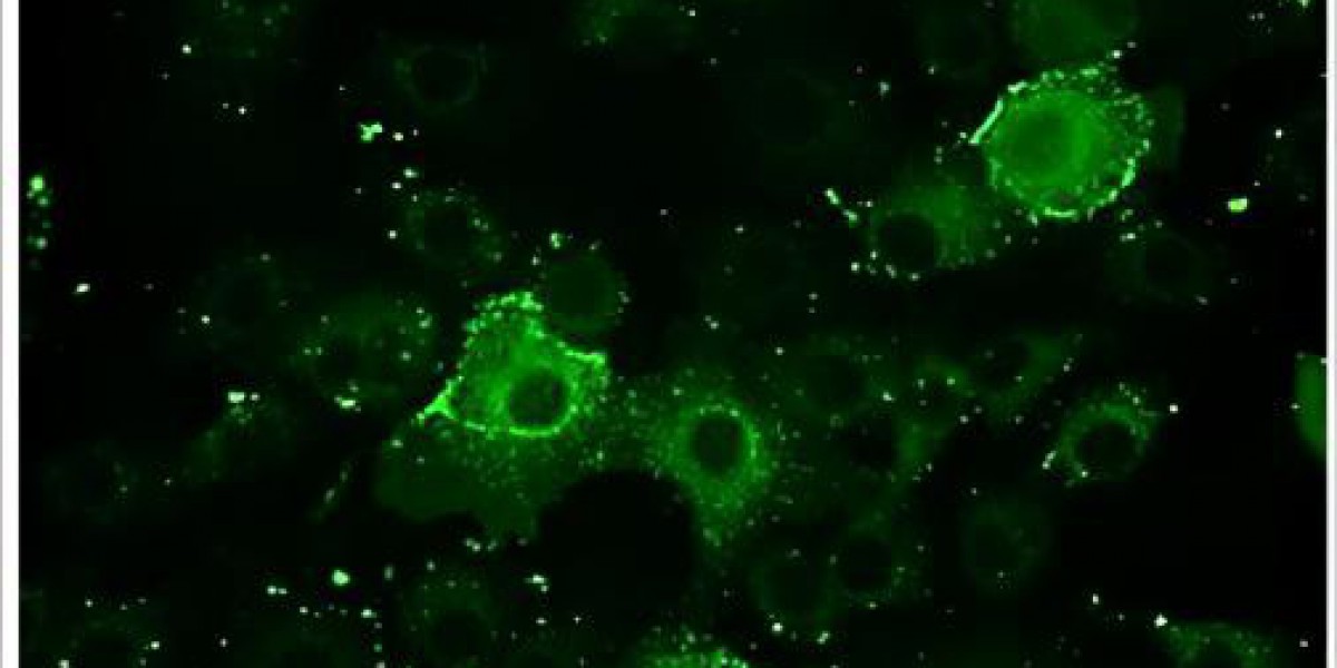 Creative Diagnostics Introduces Immunofluorescence Assay Testing Services for Virology Research